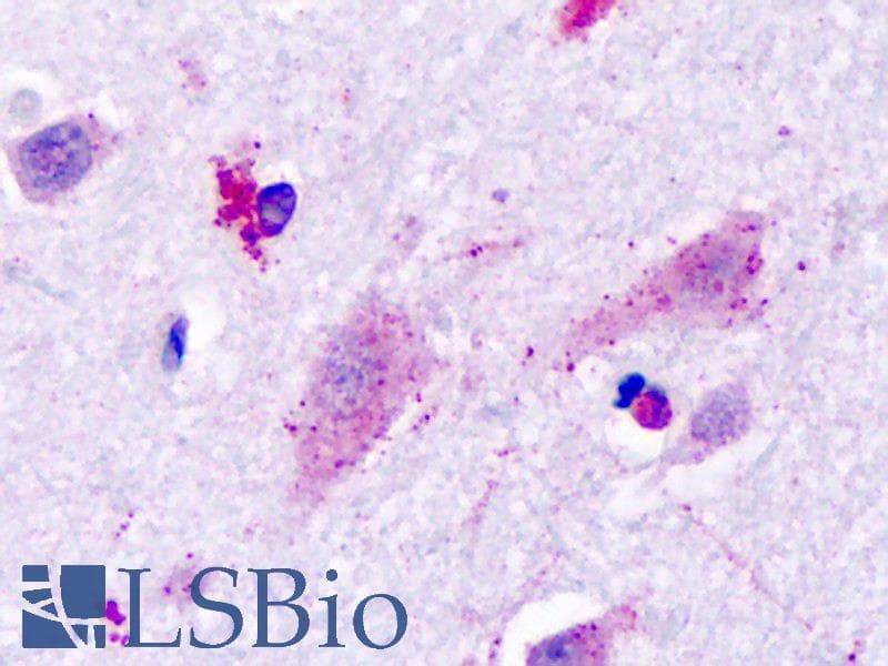 IHC-plus™ Polyclonal Rabbit anti-Human HRH3 / Histamine 3 Receptor Antibody (Cytoplasmic Domain, IHC)