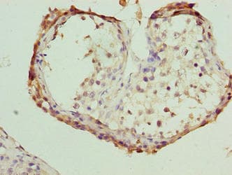 Polyclonal Rabbit anti-Human FSIP1 Antibody (IHC)