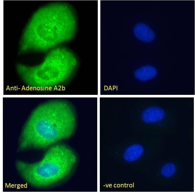 Polyclonal Goat anti-Human ADORA2B/Adenosine A2B Receptor Antibody (aa311-321, IHC, IF)