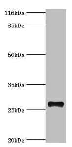 TM4SF6 / TSPAN6 Antibody