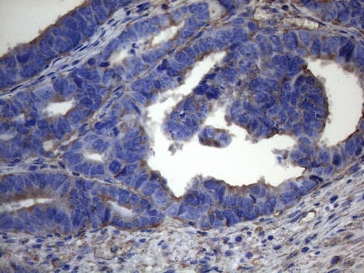 IRF3 Antibody (aa27-169, clone OTI4A1)