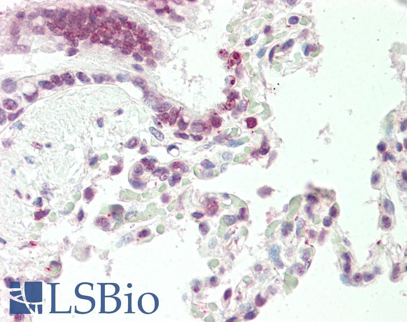 DNAJB1 / Hsp40 Antibody (aa74-123)