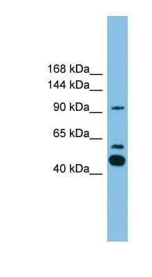 PLA2G4E Antibody (aa751-800)