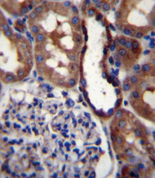 Polyclonal Rabbit anti-Human GRIK3 / GLUR7 Antibody (aa70-98, IHC, WB)