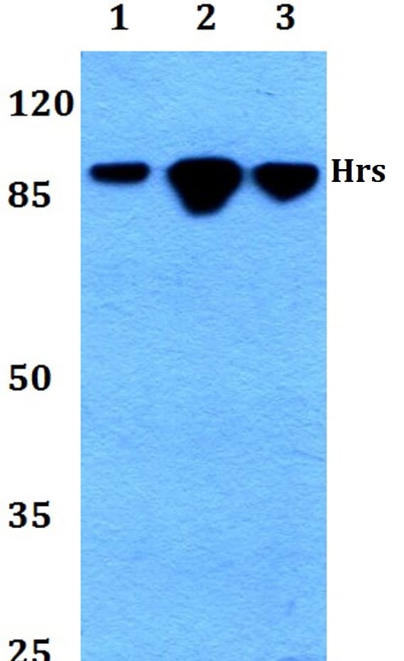 IHC-plus™ Polyclonal Rabbit anti-Human HRS / HGS Antibody (aa461-510, IHC, IF, WB)