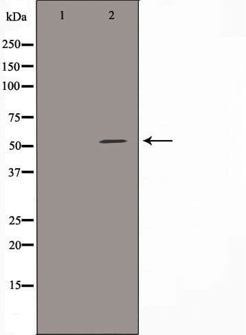 ALDH3B1 Antibody