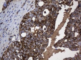 Monoclonal Mouse anti-Human NDUFB10 Antibody (clone OTI2G1, IHC, WB)
