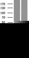 GDAP1 Protein (Over-Expression Lysate Myc-DDK (Flag))