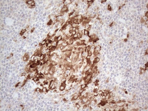 GRN / Granulin Antibody (aa327-593, clone OTI3B3)