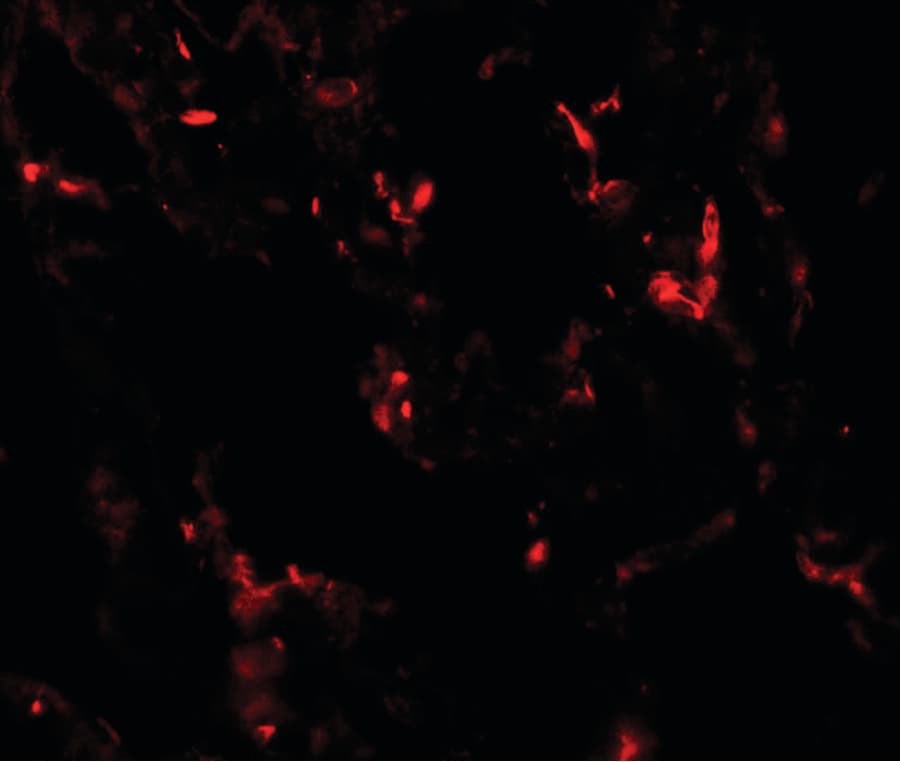 Polyclonal Rabbit anti-Human NKX2-1 / Thyroid-Specific TF Antibody (IHC, IF, WB)