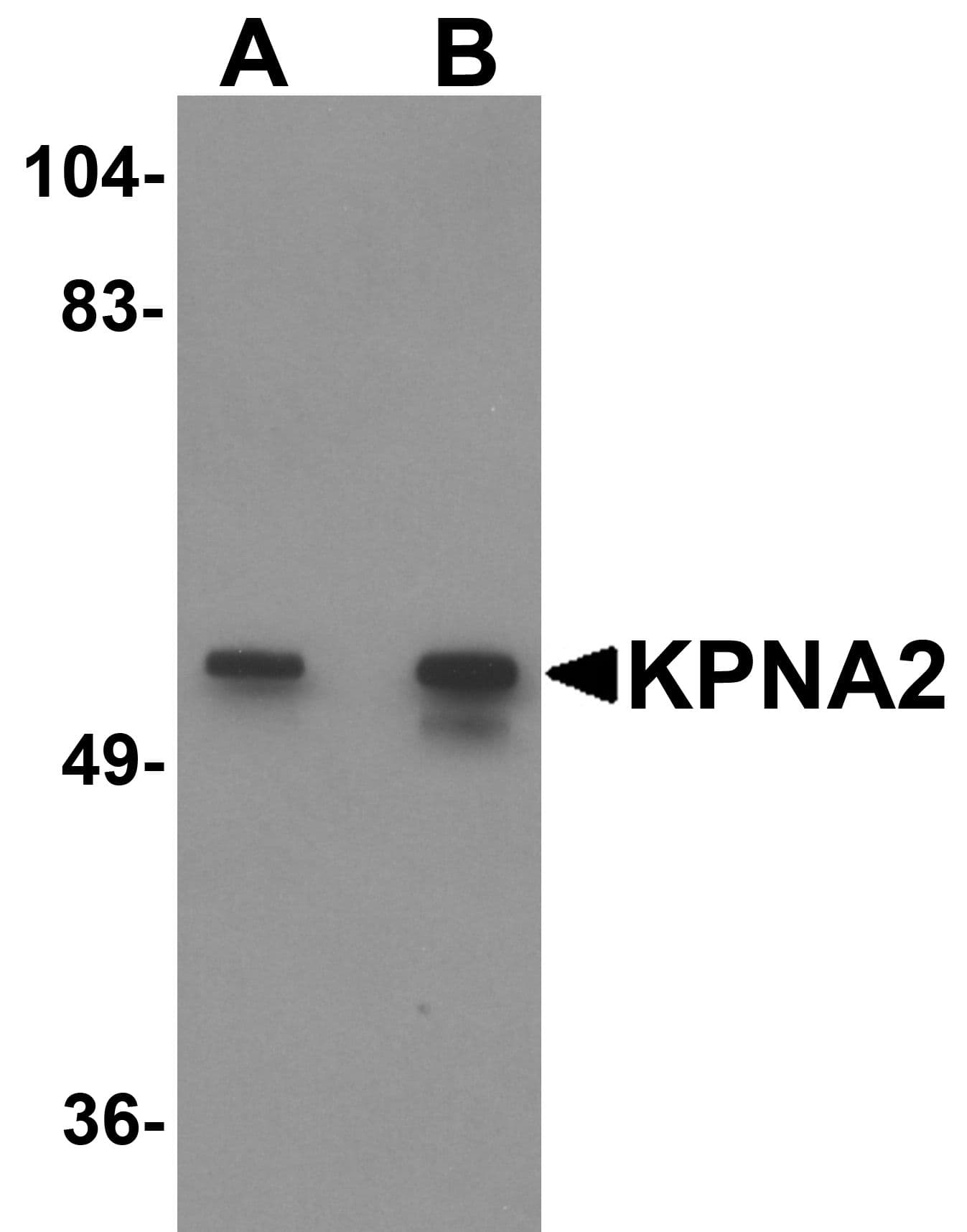 IHC-plus™ KPNA2 / Importin Alpha 1 Antibody