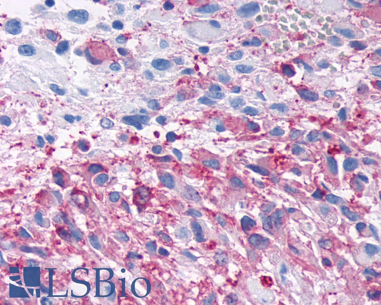 PathPlus™ Polyclonal Rabbit anti-Human FZD3 / Frizzled 3 Antibody (IHC)