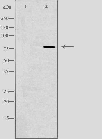 Polyclonal Rabbit anti-Human GUSB / Beta Glucuronidase Antibody (IF, WB)