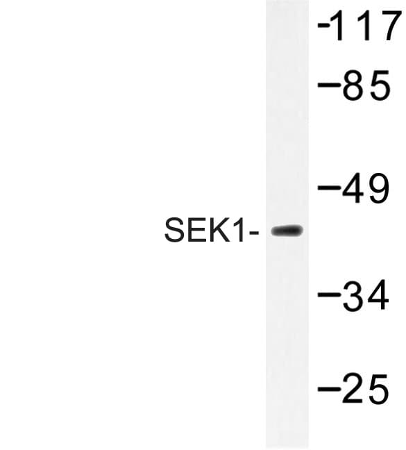MAP2K4 / MKK4 Antibody (Lys350)