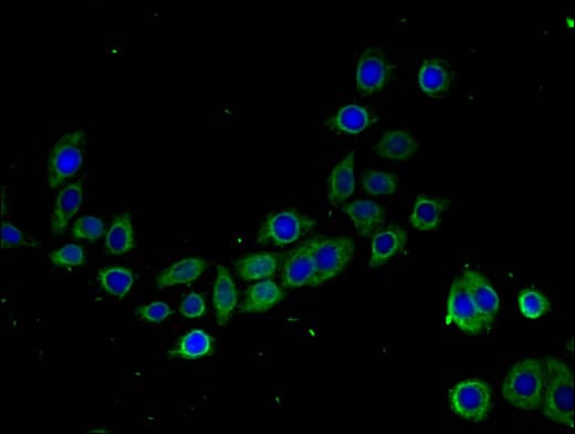 Polyclonal Rabbit anti-Human TMIGD2 Antibody (IHC, IF)