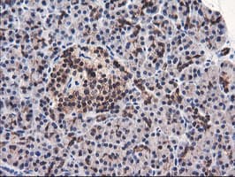 FBXO21 Antibody (clone OTI3C11, Carrier-free)