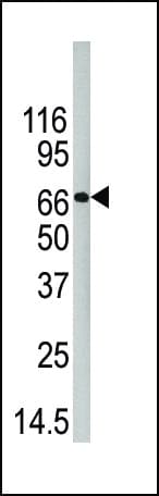 PADI4 / PAD4 Antibody (aa512-544)
