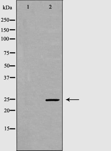 GPX5 Antibody