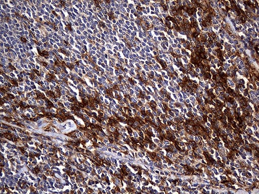Monoclonal Mouse anti-Human CPM / Carboxypeptidase M Antibody (clone OTI4E11, aa124-423, IHC, WB)