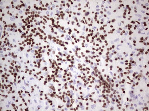 Monoclonal Mouse anti-Human IKZF3 / AIOLOS Antibody (clone OTI4H7, Carrier-free, aa1-301, IHC, WB)