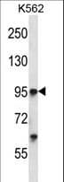 TIE1 / TIE Antibody (aa361-389)