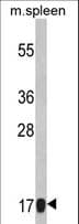 Polyclonal Rabbit anti-Human RPS18 / Ribosomal Protein S18 Antibody (aa62-91, IHC, WB)