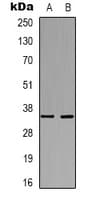 FCER2 / CD23 Antibody
