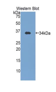OTC Antibody (aa78-342, FITC)