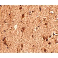 SLITRK3 Antibody