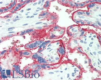 IHC-plus™ ALPPL2 Antibody (aa58-86)
