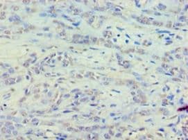 EEF1E1 / AIMP3 Antibody (aa2-174)