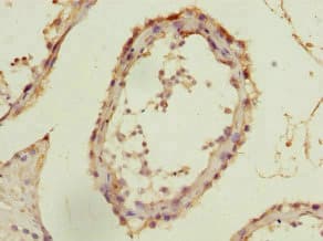 FIBP Antibody