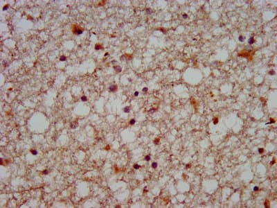SLC12A5 / KCC2 Antibody