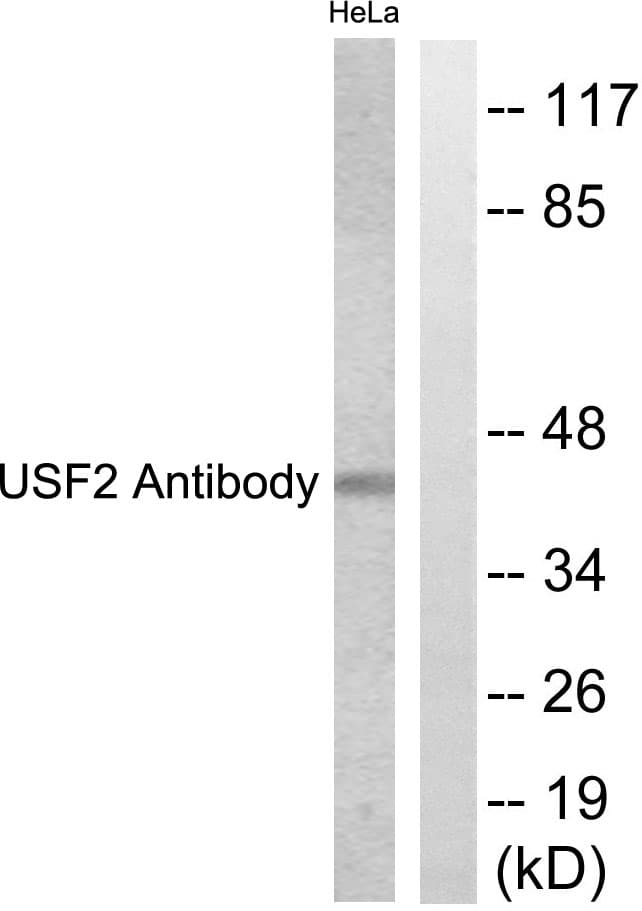 USF2 Antibody (aa196-245)