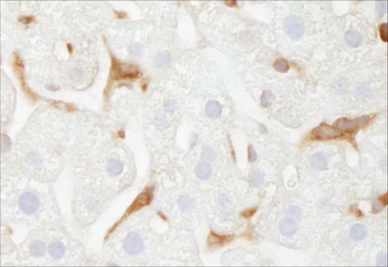 Polyclonal Rabbit anti-Human G6PD Antibody (aa50-100, IHC)