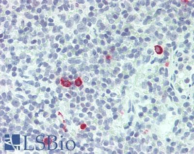 Polyclonal Rabbit anti-Human IL3 Antibody (aa20-152, IHC, WB)