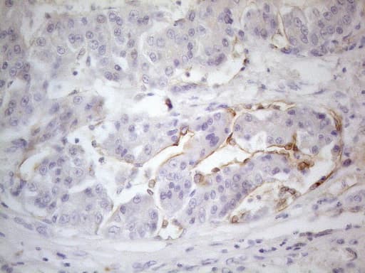 Monoclonal Mouse anti-Human PODXL / Podocalyxin Antibody (clone OTI8D6, aa32-461, IHC)