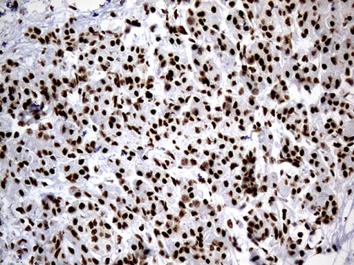 Monoclonal Mouse anti-Human HNRNPH1 / hnRNP H Antibody (clone OTI4F10, Carrier-free, IHC, WB)