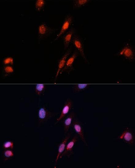 SMAD5 Antibody