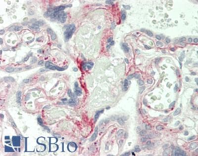 PathPlus™ Monoclonal Mouse anti-Human LAMC1 / Laminin Gamma 1 Antibody (clone BC17, Concentrated, IHC)