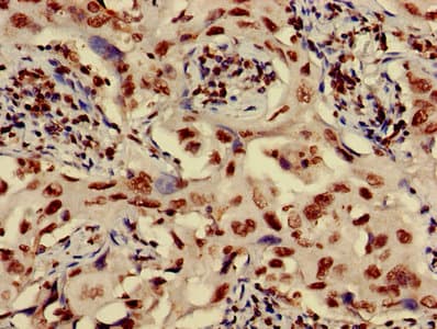 HIST1H3A Antibody