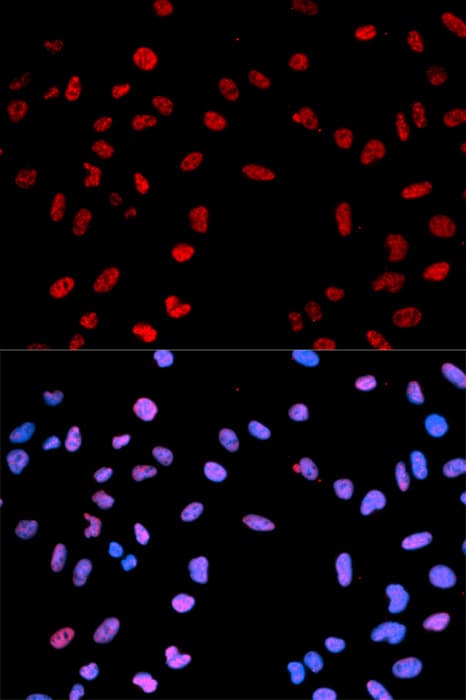 AKT1 Antibody (phospho-Thr450)