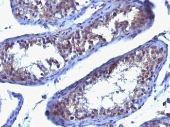 Monoclonal Mouse anti-Human PRLR / Prolactin Receptor Antibody (clone SPM213, IHC, IF)