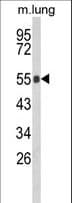 GBA / Glucosidase Beta Acid Antibody (aa337-365)