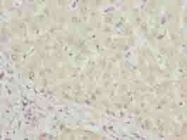 Polyclonal Rabbit anti-Human DHRS3 / SDR1 Antibody (IHC, WB)