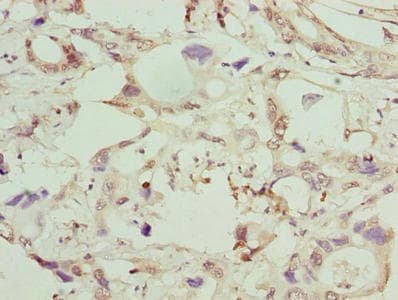 Polyclonal Rabbit anti-Human GGTLA4 / GGTLC1 Antibody (IHC)