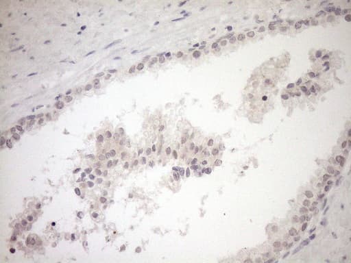 Monoclonal Mouse anti-Human Myozenin / MYOZ1 Antibody (clone OTI4C2, aa106-299, IHC, WB)