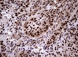 Monoclonal Mouse anti-Human NBN / Nibrin Antibody (clone OTI8E7, IHC, WB)