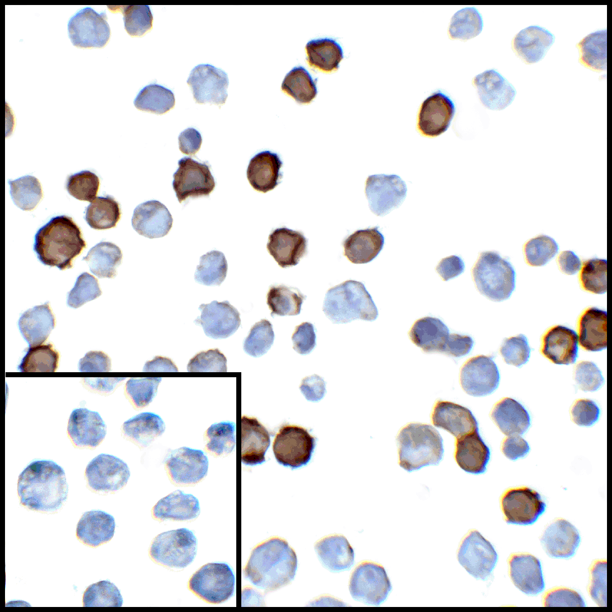 IHC-plus™ Monoclonal Mouse anti-Human PD-L2 / PDCD1LG2 / CD273 Antibody (clone 7C7, IHC, IF, WB)