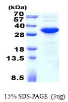 Human KCTD15 Protein (Recombinant His)